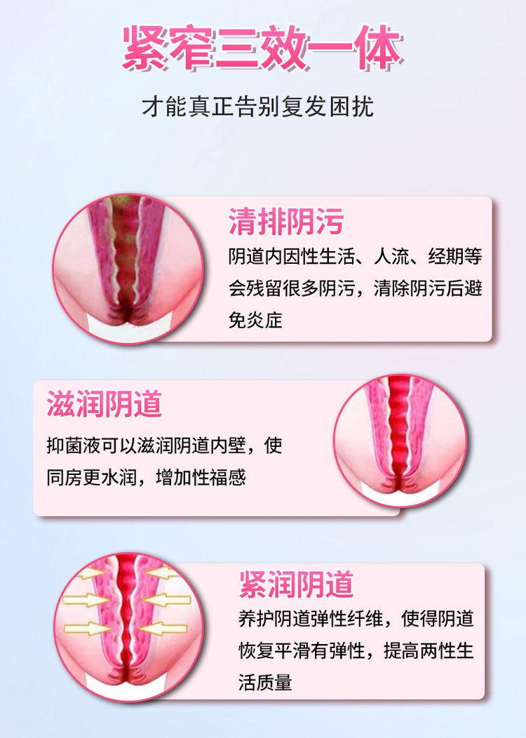 冰凝舒茵緊潤婦科膠囊讓你告別復發困擾