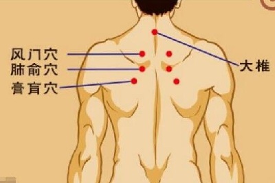 三伏貼連續(xù)貼幾天？看看中醫(yī)師的建議！